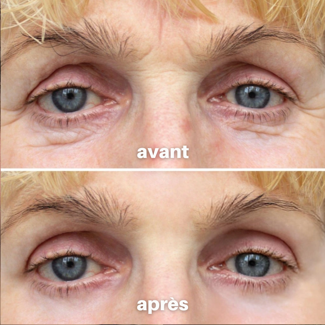 ParisLuxy™ • Sérum Anti-âge