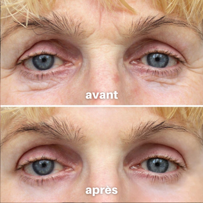 ParisLuxy™ • Sérum Anti-âge